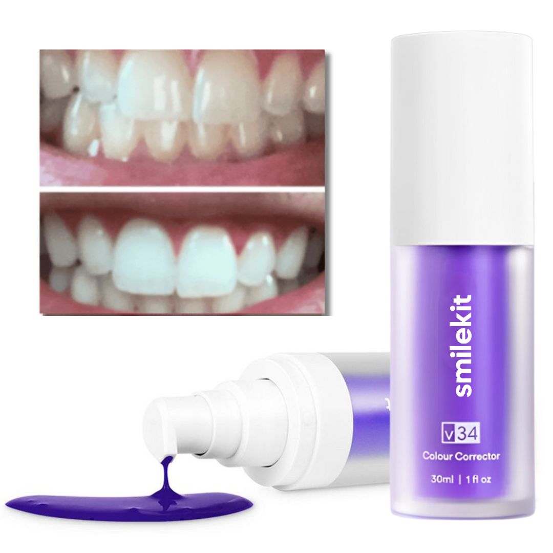 Clareador Dental v.34 Smilekit